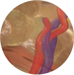 선택적인 지방 세포막 파괴