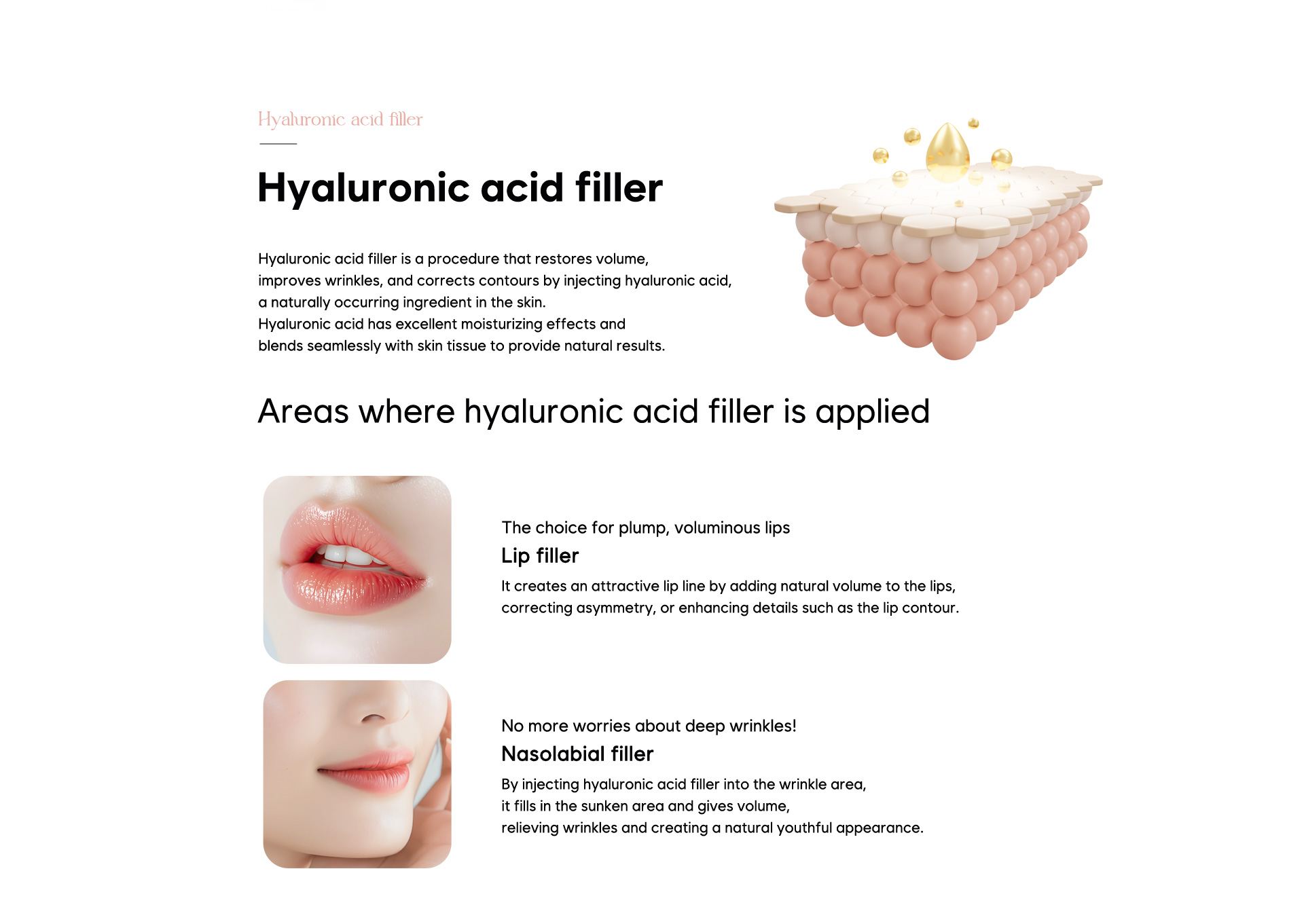 Hyaluronic acid