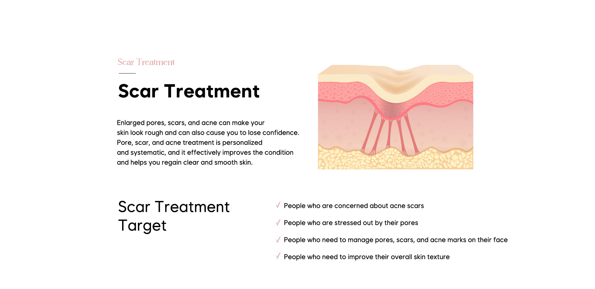 Scar Treatment