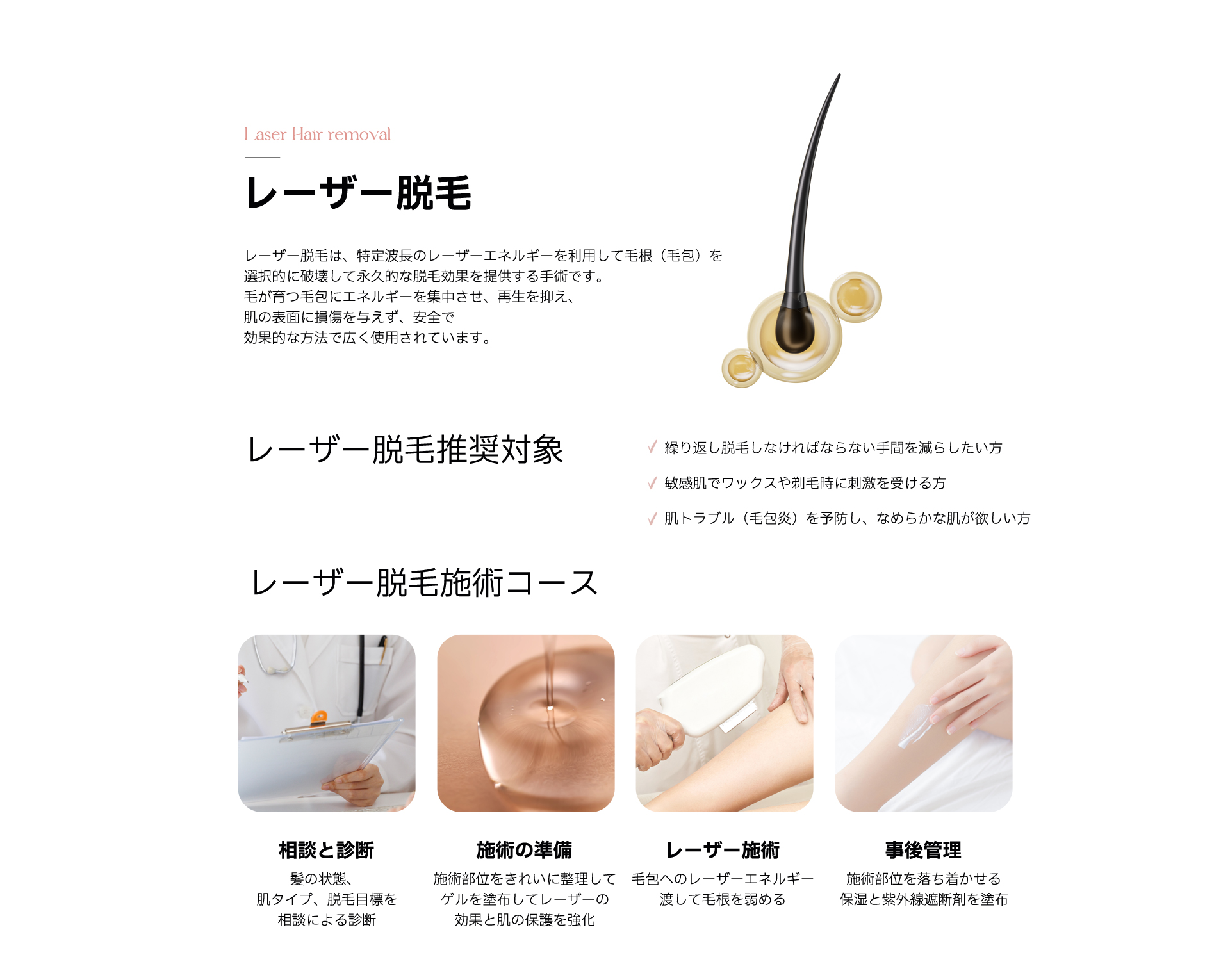 Laser hair removal
