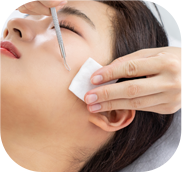 Acne Extrusion